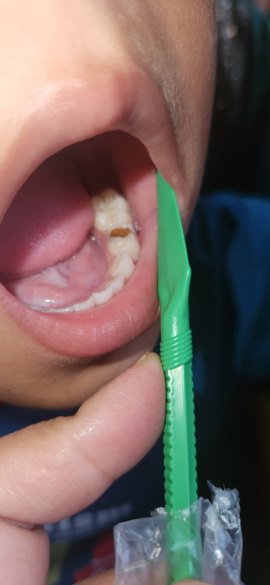 Free Oral Health and Eye Camp